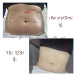 이사빛바디케어