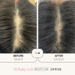 루비셀 뷰티랩 무양점 | 루비셀뷰티랩 김포한강점
