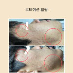 미담 스킨앤바디(美담 skin&body) | 빛담스킨랩