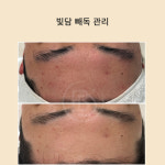 미담 스킨앤바디(美담 skin&body) | 빛담스킨랩