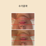 미담 스킨앤바디(美담 skin&body) | 빛담스킨랩
