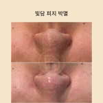 미담 스킨앤바디(美담 skin&body) | 빛담스킨랩