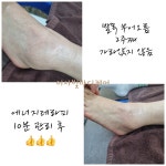 이사빛바디케어