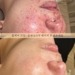 가봄 에스테틱 부산서면점