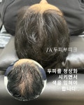 제이케이코스메틱 블랙점 | 제이케이두피부띠크