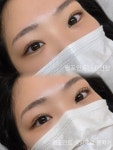 단미·루근뇌에스테틱 | 단미에스테틱