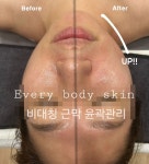 에브리바디스킨