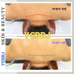 예쁘제이뷰티