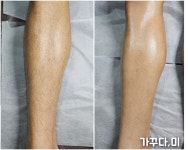 가꾸다,미 왁싱&스킨바디