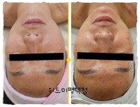 위드미 오산비전탑점 | 위드미 평택점