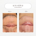 최하라테라피 | 왁싱백프로&테라피
