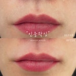 뷰티37.5ºC | 진저뷰티&왁싱