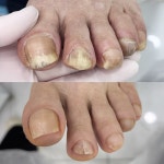 레푸스 화서역점 풋케어 발톱 발각질 문제성 발관리전문점
