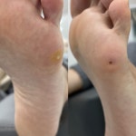 레푸스 화서역점 풋케어 발톱 발각질 문제성 발관리전문점