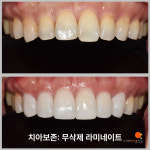 오앤오치과의원
