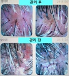 해드스파케이노블랑스 | 힐헤드스파