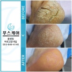 푸스양주 | 푸스케어 통영점 바르고운네일