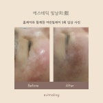 빛날희
