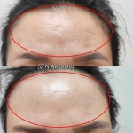리에스테틱 엔 왁싱 | 앤 에스테틱