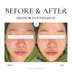 보네르슈가 왁싱&피부 인천연수점
