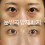 청담이지성형외과의원