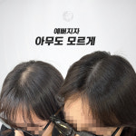 생명나무두피프렌즈 | 두피움SMP