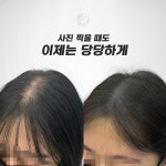 생명나무두피프렌즈 | 두피움SMP