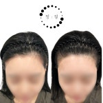 부산두피케어G&B아카데미 | 정점 두피&탈모관리 부산본점