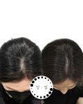 부산두피케어G&B아카데미 | 정점 두피&탈모관리 부산본점