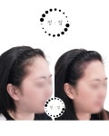 부산두피케어G&B아카데미 | 정점 두피&탈모관리 부산본점