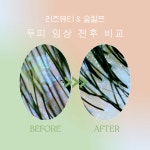 골드뷰티앤숲칼프 | 리즈뷰티&숲칼프
