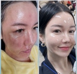 인셀덤드림빛나다