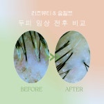 골드뷰티앤숲칼프 | 리즈뷰티&숲칼프