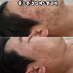 물오른피부 창원점