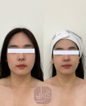 메르오르코스테틱언주역점 | 비오르에스테틱