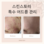 Skin essay(스킨 에세이) | 스킨스토리