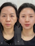 먼로뷰티토탈샵(MONROE) | 예쁨토탈뷰티샵
