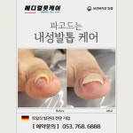 독일식문제성손발관리전문점푸스플레게장연자 | 내성발톱 무좀발톱 메디컬풋케어 & 푸스플레게