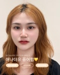 어나더유