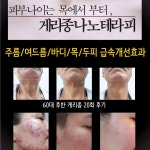 스칼렛포톤힐링센타 | 주영뷰티바이오포톤힐링센터