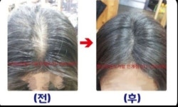 샤이나프로헤어 | 샤이나헤어by가발백화점하이넷