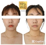 엑소바이옴메이약손테라피지점 - 동구 동부로30길 53 | 비대칭 체형관리 약손금손