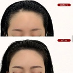 올스뷰티 눈썹문신 두피문신 헤어라인 인천송도본점