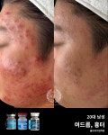 허지원 피부연구소 | 피부천재연구소