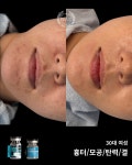 허지원 피부연구소 | 피부천재연구소