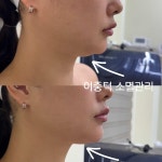 최선희뷰티앤스킨 | 지아뷰티앤스킨