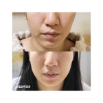 미소뉴스킨관리판매 | 미소스킨앤바디