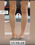 제이테라피