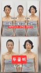 에바다 코스메틱(주) 능곡점 | 에바다에스테틱얼굴축소연구소