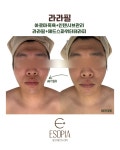 에소테릭명상에스테틱 | 에소피아에스테틱